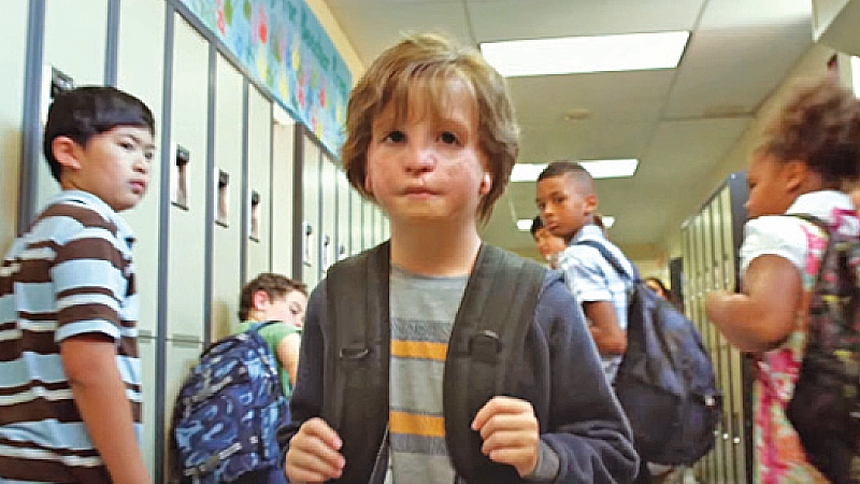 Từ nhỏ đã bị xa lánh và gọi là "quái vật" vì ngoại hình méo mó, cuộc sống của cậu bé nguyên mẫu trong bộ phim Wonder bây giờ ra sao? - Ảnh 4.