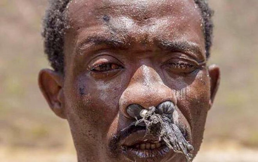 Đây là một trong những công việc độc hại nhất thế giới – Làm 3 năm có thể bị mù điếc, từ da đen biến thành da trắng - Ảnh 2.