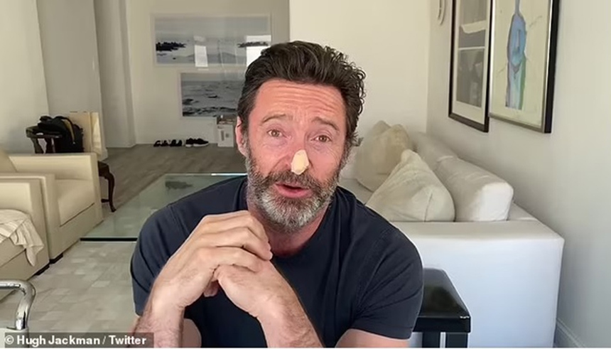 'Người Sói' Hugh Jackman mắc ung thư da, kêu gọi mọi người bảo vệ da - Ảnh 1.