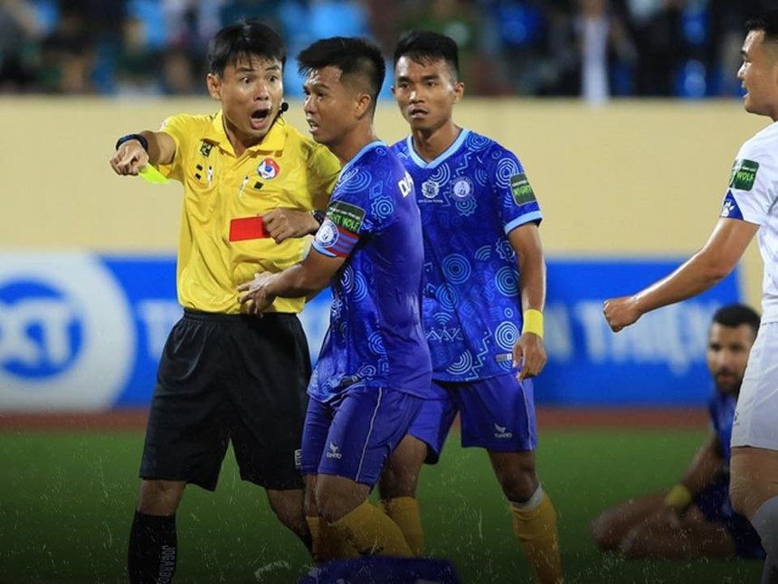 Trọng tài Trương Hồng Vũ mắc sai lầm nghiêm trọng ở trận Nam Định gặp Khánh Hòa ở V-League Trọng tài Trương Hồng Vũ mắc sai lầm nghiêm trọng ở trận Nam Định gặp Khánh Hòa ở V-League