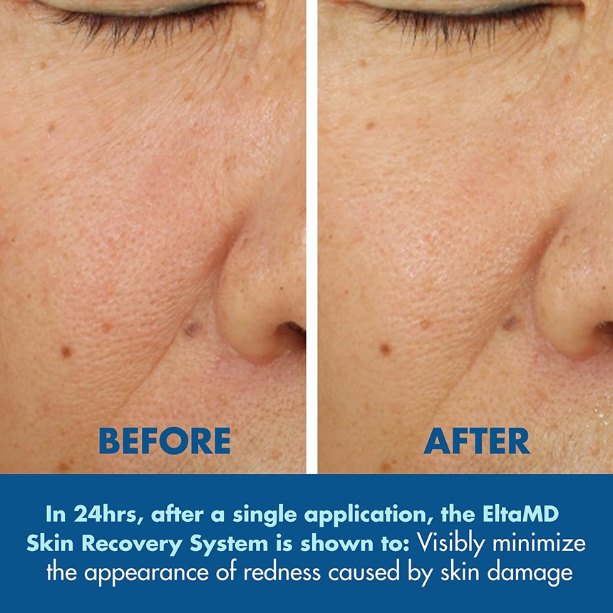 Serum phục hồi da yêu thích của Hailey Bieber: Hiệu quả đến độ BTV làm đẹp phải khuyên mẹ 57 tuổi dùng để chống già, cấp ẩm và trị mụn  - Ảnh 3.