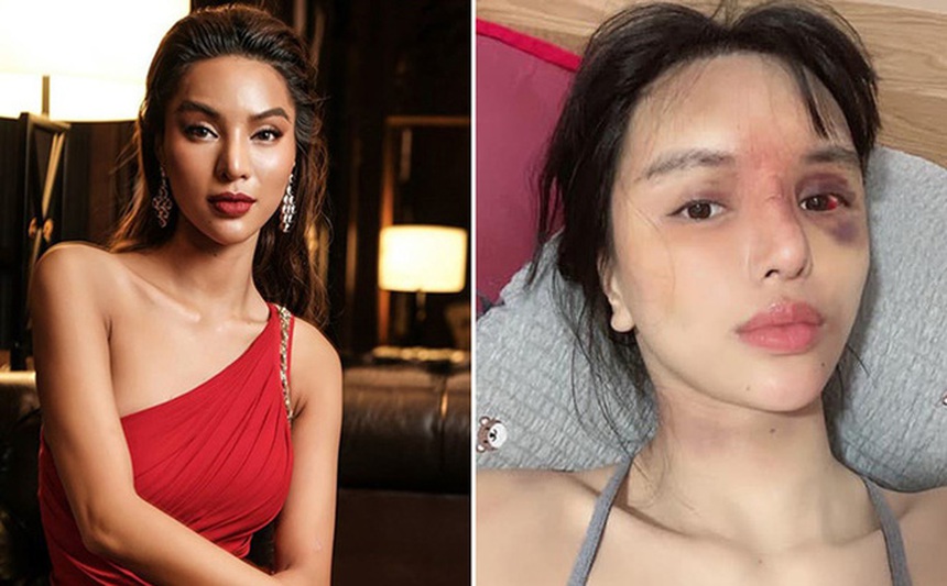 Sao nữ bị bạo hành gây chấn động Vbiz và cuộc sống làm mẹ đơn thân hiện tại ra sao? - Ảnh 3. Sao nữ bị bạo hành gây chấn động Vbiz và cuộc sống làm mẹ đơn thân hiện tại ra sao? - Ảnh 3.