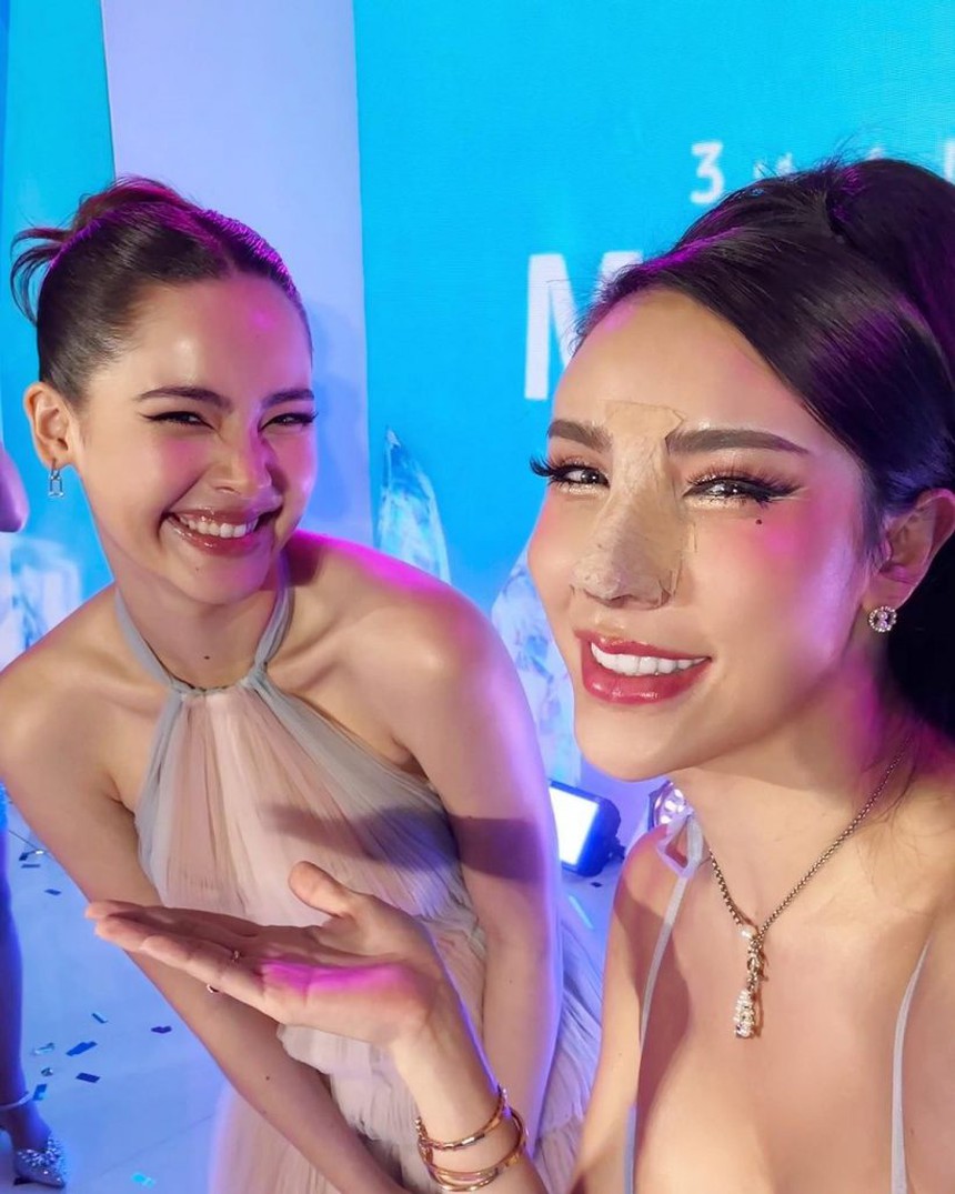 Độc lạ Tbiz: Sao nữ chưa tháo nẹp mũi sau phẫu thuật thẩm mỹ đã vội dự sự kiện, còn tự tin đọ sắc với Yaya Urassaya - Ảnh 3.