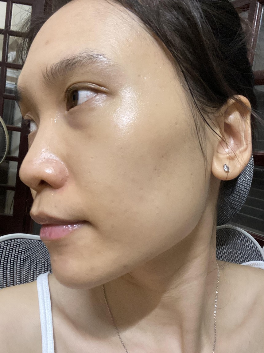 Đánh giá cặp đôi giúp giảm mụn chiết xuất cà rốt: Hiệu quả thấy rõ chỉ sau 2 tuần, tuy nhiên vẫn có 1 điểm trừ nhỏ  - Ảnh 5.