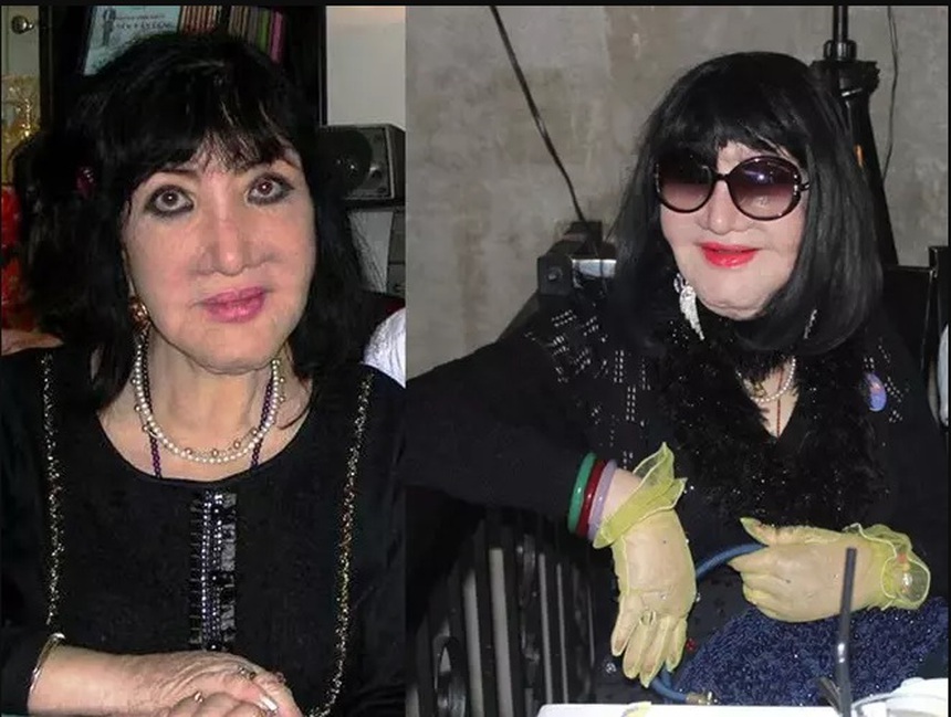 Thẩm Thuý Hằng và những ngôi sao trở thành ‘thảm hoạ thẩm mỹ’ vì ‘dao kéo’ - Ảnh 4.