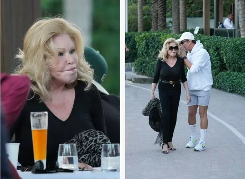 Thẩm Thuý Hằng và những ngôi sao trở thành ‘thảm hoạ thẩm mỹ’ vì ‘dao kéo’ - Ảnh 12.