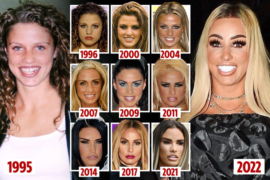 Thẩm Thuý Hằng và những ngôi sao trở thành ‘thảm hoạ thẩm mỹ’ vì ‘dao kéo’ - Ảnh 16.