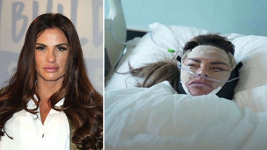 Thẩm Thuý Hằng và những ngôi sao trở thành ‘thảm hoạ thẩm mỹ’ vì ‘dao kéo’ - Ảnh 17.