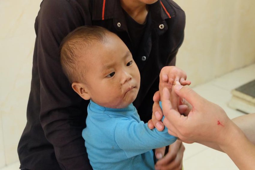 Phẫu thuật cho trẻ khuyết tật và tổ chức các hoạt động thiện nguyện tại bệnh viên đa khoa tỉnh Hà Giang - Ảnh 2.