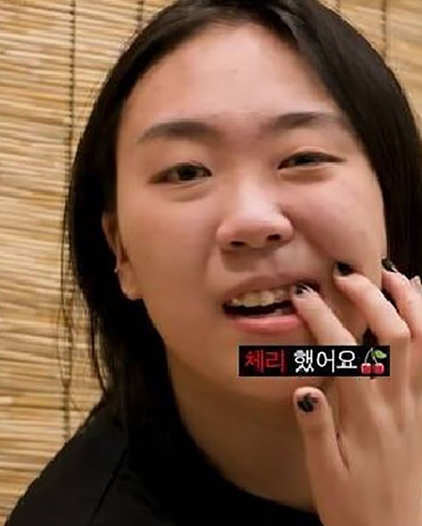 Từ HyunA đến Lisa Blackpink, 'tooth gem' đang trở thành trend trong K-biz - Ảnh 5.