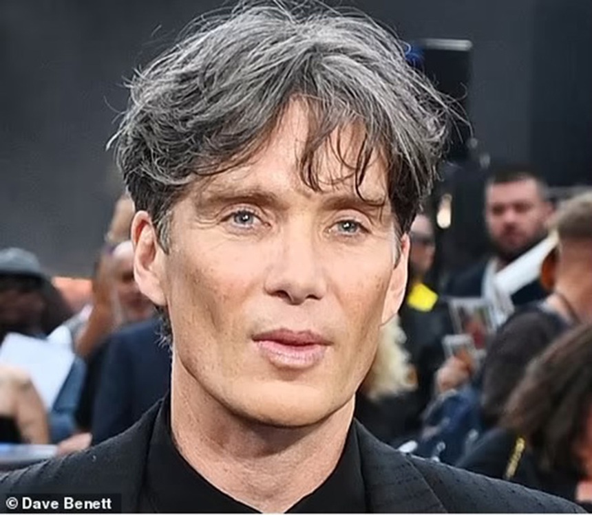 Khi các sao Hollywood làm biến dạng cơ thể cho vai diễn: Cillian Murphy, Charlize Theron… - Ảnh 15.