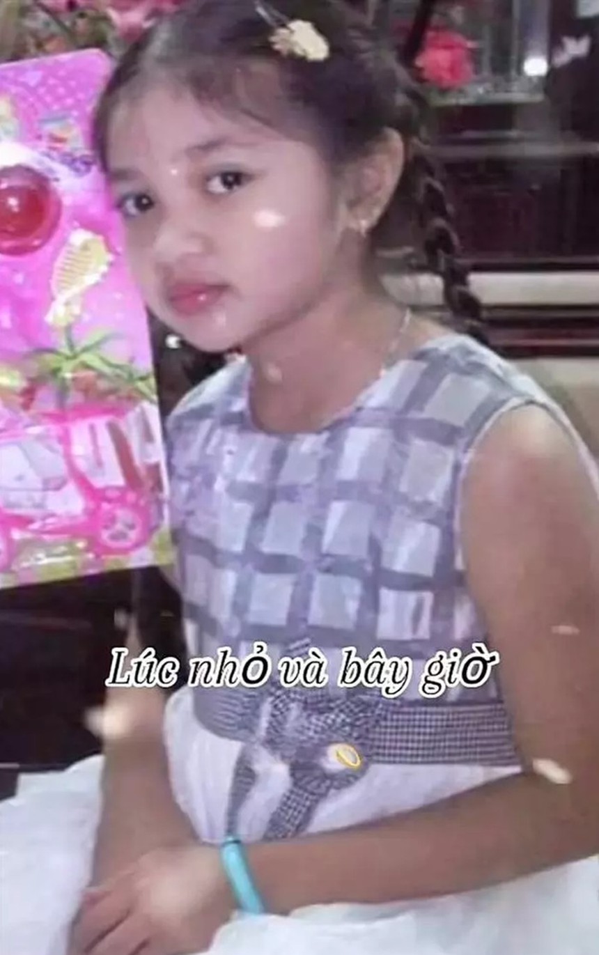 Á hậu Minh Kiên khéo léo bác bỏ tin đồn can thiệp phẫu thuật thẩm mỹ  - Ảnh 3.