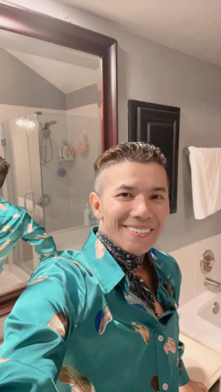 Lý do khiến Kasim Hoàng Vũ mặt biến dạng, phải phẫu thuật xương hàm và cổ - Ảnh 2.