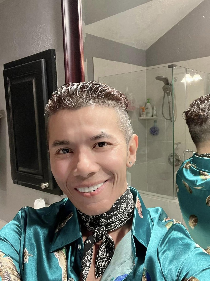 Lý do khiến Kasim Hoàng Vũ mặt biến dạng, phải phẫu thuật xương hàm và cổ - Ảnh 3.