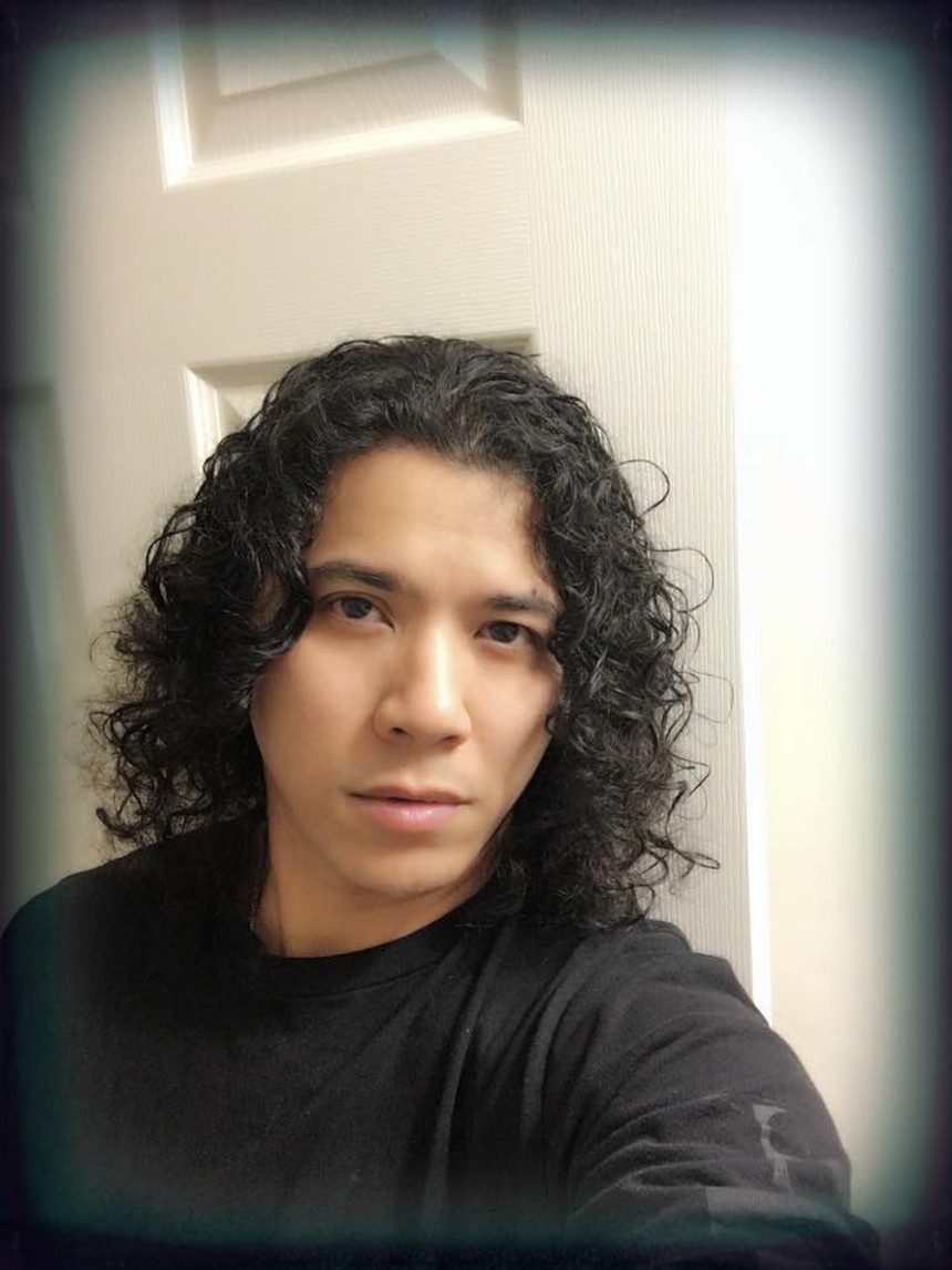 Lý do khiến Kasim Hoàng Vũ mặt biến dạng, phải phẫu thuật xương hàm và cổ - Ảnh 1.