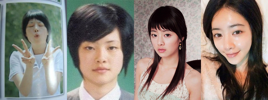 Những ngôi sao K-biz biến dạng vì phẫu thuật thẩm mỹ: Park Bom, Hong Soo Ah...  - Ảnh 4.