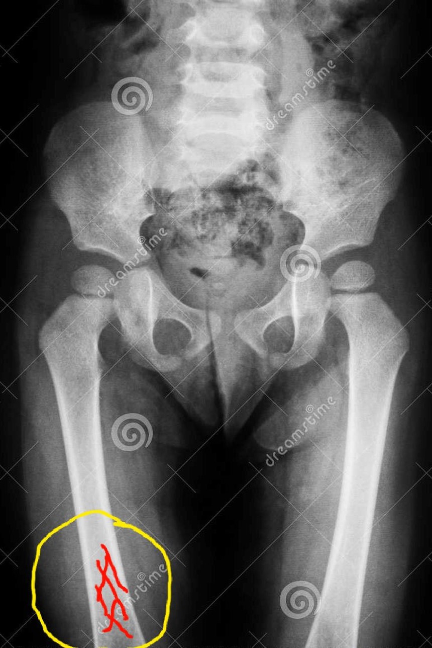 Thế giới người lớn Đông Sơn (kỳ 4): Người đàn bà chết vì tai nạn ở Xóm Rền 3.500 năm trước - Ảnh 2. Thế giới người lớn Đông Sơn (kỳ 4): Người đàn bà chết vì tai nạn ở Xóm Rền 3.500 năm trước - Ảnh 2.