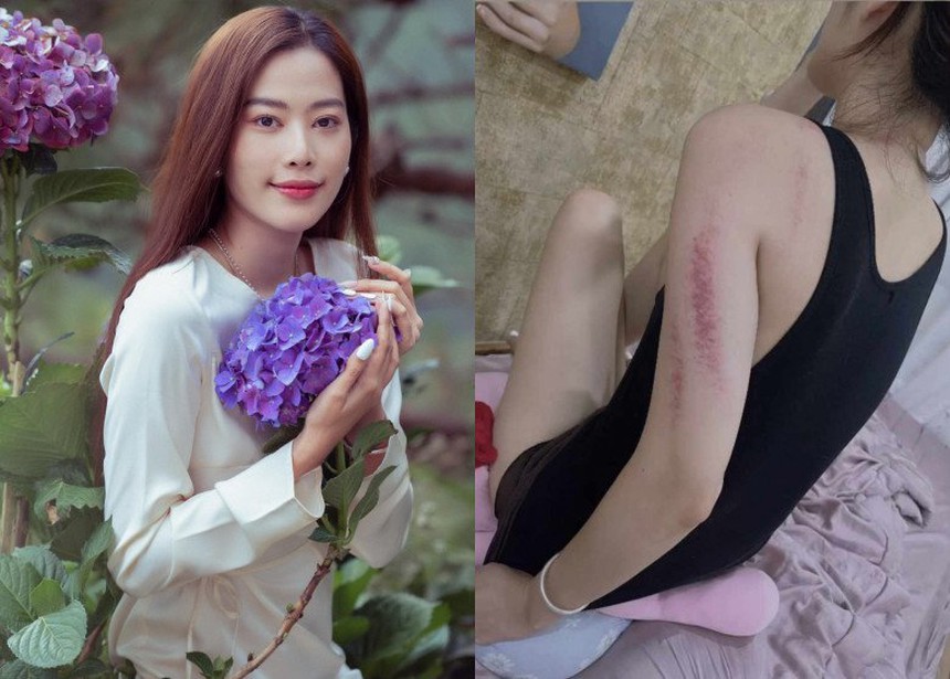 Cát Tường bị trúng gió khiến người nước ngoài phải báo cảnh sát - Ảnh 4.