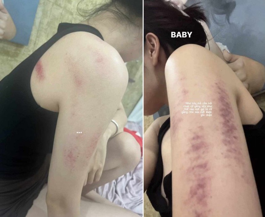 Cát Tường bị trúng gió khiến người nước ngoài phải báo cảnh sát - Ảnh 5.