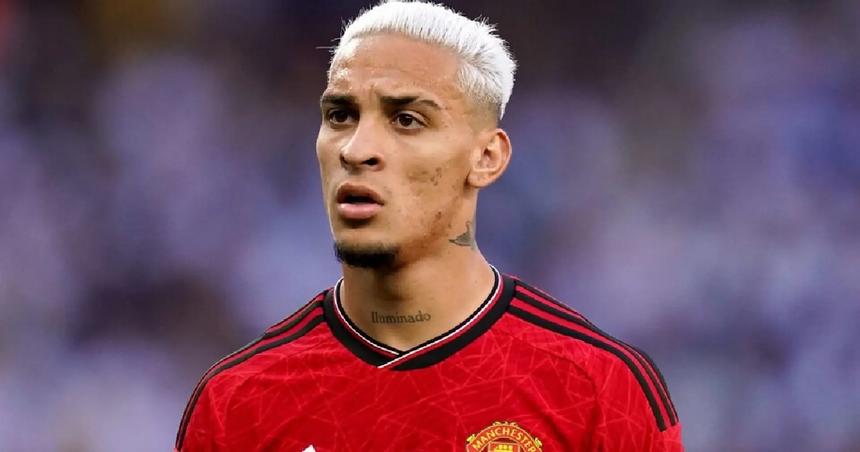 Tin bóng đá MU 18/9: Ten Hag thừa nhận áp lực ở MU, đón tin vui về lực lượng - Ảnh 6.