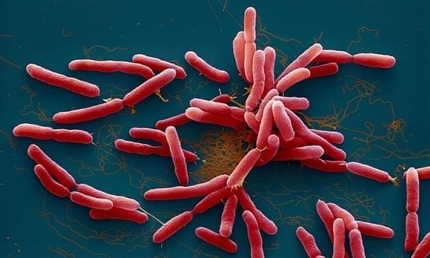  Hiểu đúng về bệnh Whitmore và cách phòng bệnh - Ảnh 1.