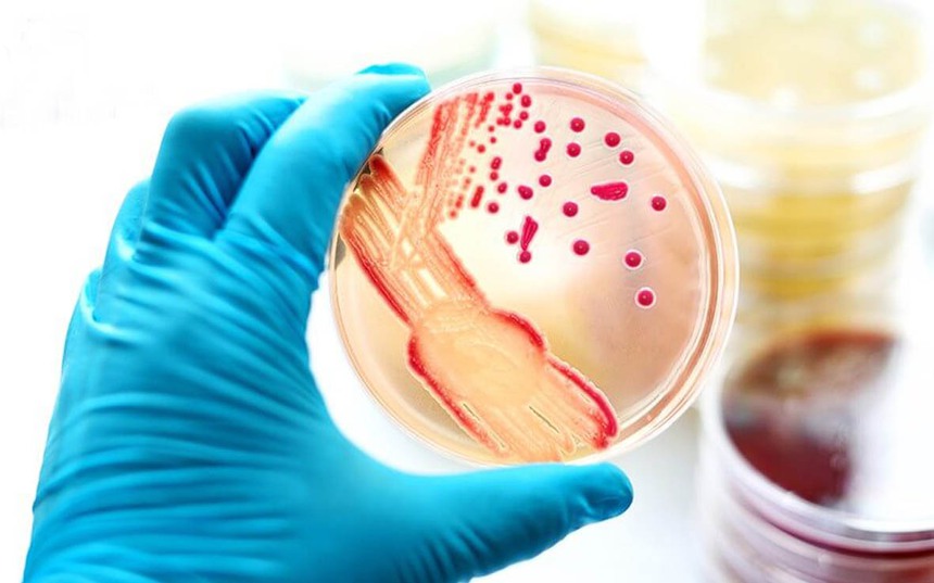 Chuyên gia y tế khuyến cáo các biện pháp phòng ngừa bệnh đậu mùa khỉ - Ảnh 1.