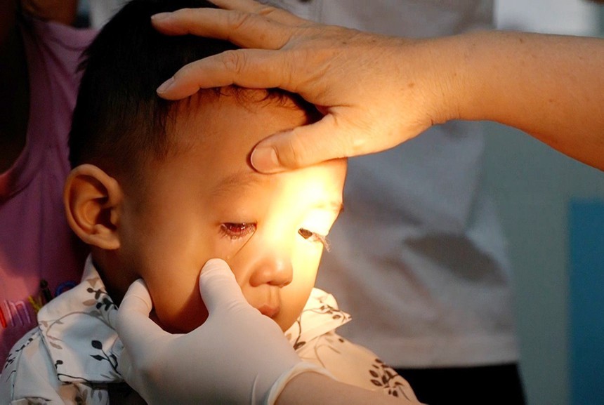 Nhiều người bị đau mắt đỏ, Sở Y tế Thành phố Hồ Chí Minh truy tìm tác nhân gây bệnh - Ảnh 1. Nhiều người bị đau mắt đỏ, Sở Y tế Thành phố Hồ Chí Minh truy tìm tác nhân gây bệnh - Ảnh 1.