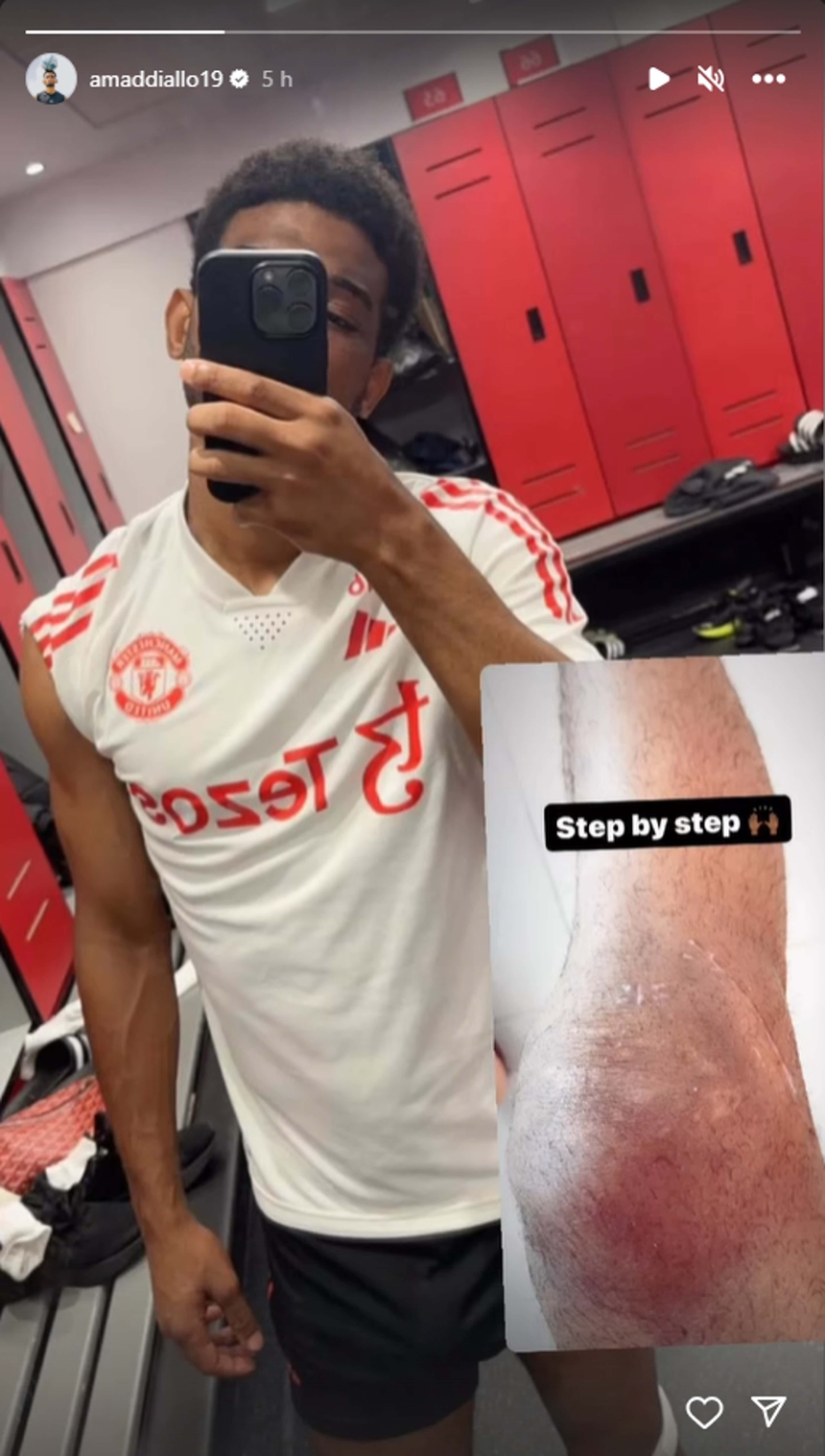 Tin bóng đá MU 7/9: MU lên tiếng trước cáo buộc bao che cho hành vi đánh bạn gái của Antony - Ảnh 6.