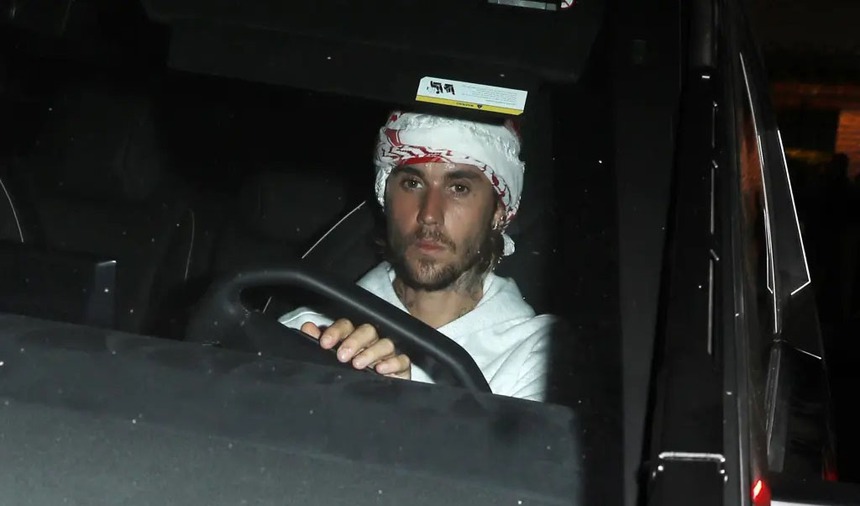 Justin Bieber đang ở trong tình trạng tinh thần khó khăn" sau khi Diddy bị bắt - Ảnh 2.