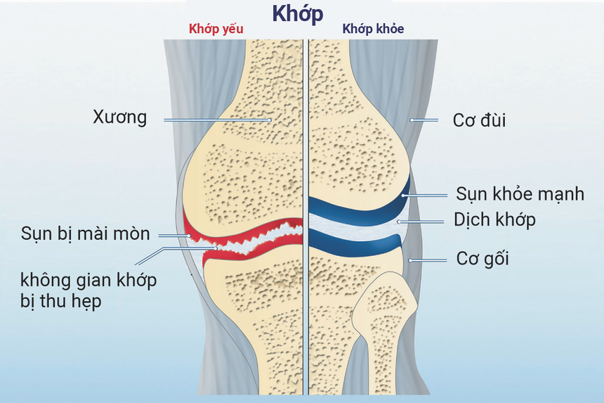 Review: Collagen Xương khớp CH-Alpha PLUS có hiệu quả không? - Ảnh 1.