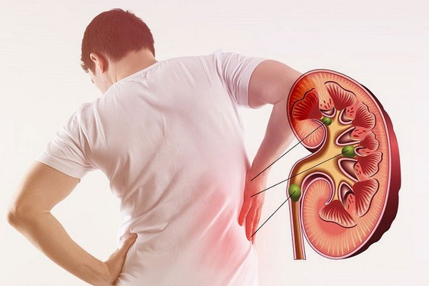 Vai trò của axit amin với bệnh thận - Ảnh 1. Vai trò của axit amin với bệnh thận - Ảnh 1.
