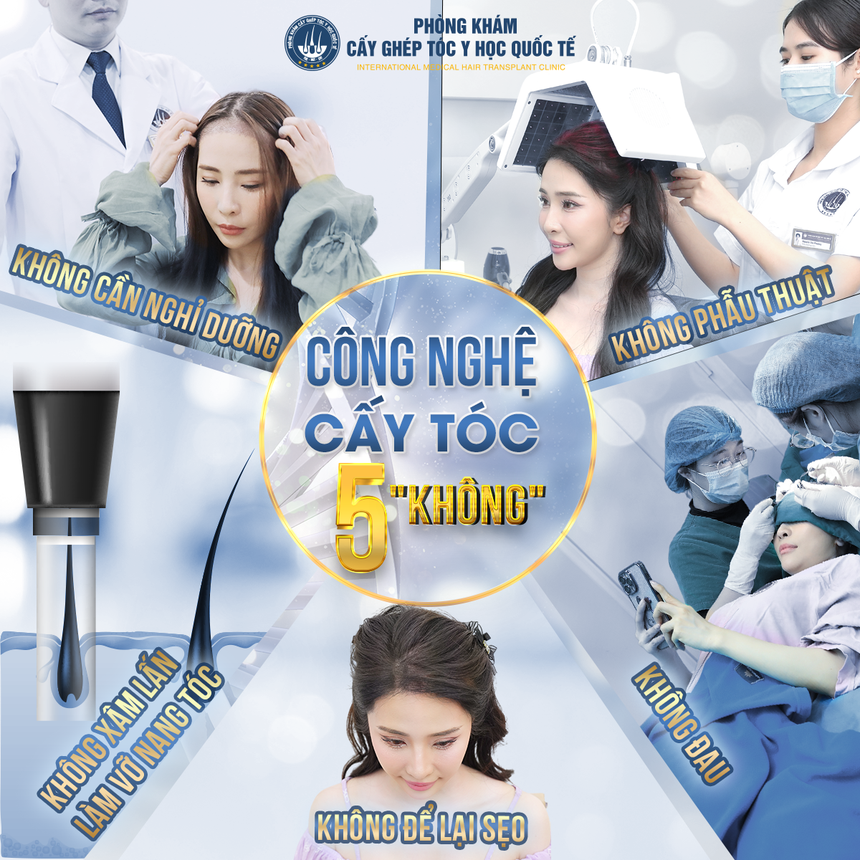Khám phá công nghệ cấy tóc hiện đại tại Viện cấy tóc Quốc tế - Ảnh 5.