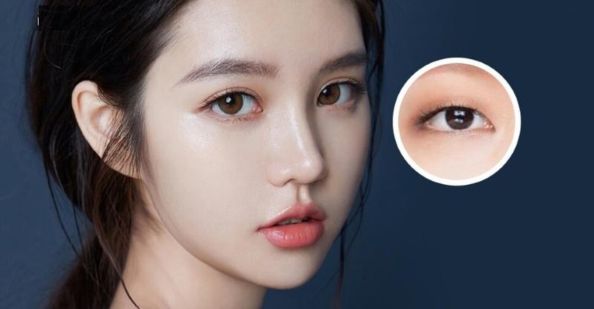 Nhấn mí mắt có an toàn không? Giá bao nhiêu? - Ảnh 2. Nhấn mí mắt có an toàn không? Giá bao nhiêu? - Ảnh 2.