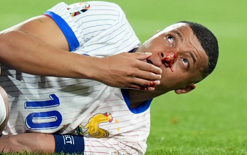 Cabin BLV: Nếu Pháp vắng Mbappe, Hà Lan dễ đá hơn - Ảnh 1.