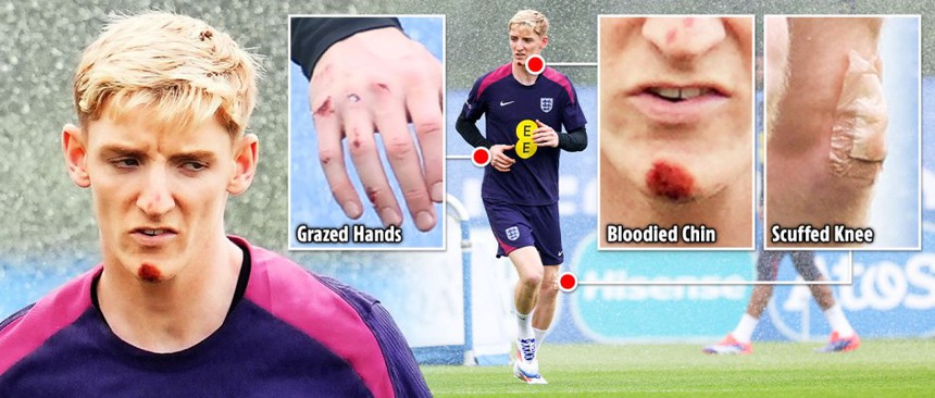 Tin nóng EURO 28/6: UEFA trừng phạt trọng tài mắc sai lầm ở EURO 2024, Pháp lục đục nội bộ - Ảnh 5.