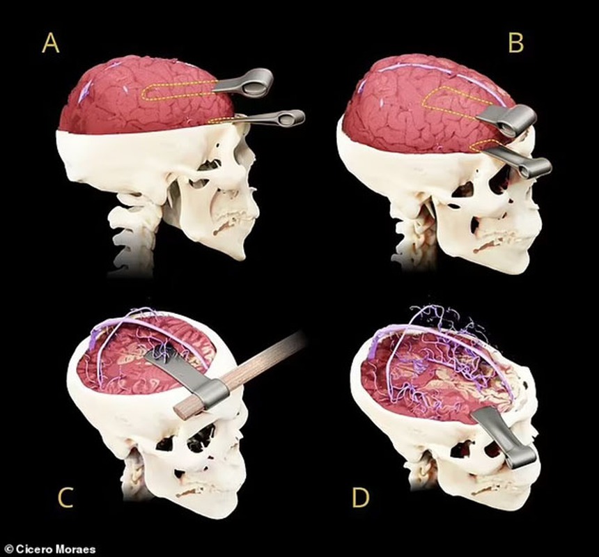 Hình dáng của pharaoh chiến binh Ai Cập được mệnh danh là "Người dũng cảm" 3.500 năm sau khi ông bị giết  - Ảnh 7.