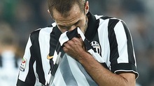 CHÍNH THỨC: Juventus mất Chiellini trước Chung kết Champions League
