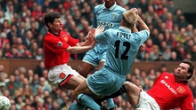 19 năm sau chấn thương kinh hoàng tại Old Trafford, cái chân của David Busst vẫn gây ám ảnh