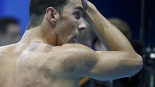 Vì sao Michael Phelps và VĐV Mỹ mê... giác hơi?