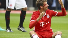 Mueller đổ cả máu, Bayern Munich vẫn chia điểm thất vọng