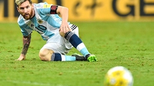 Argentina trong gương mặt 'lem luốc'