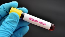 Indonesia kêu gọi cảnh giác với virus Nipah