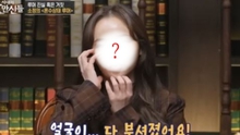 Nữ idol Kpop gặp di chứng khủng khiếp sau vụ tai nạn thảm khốc của Ladies' Code: "Mặt tôi bị hủy hoại"