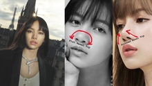 Netizen tranh cãi: Lisa Blackpink có sửa mũi hay không?