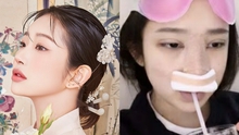 Con gái nữ minh tinh quá cố Choi Jin Sil công bố loạt ảnh ngay sau khi phẫu thuật thẩm mỹ: Bày tỏ sự hối hận?