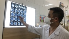 Vụ 37 công nhân nhiễm độc methanol tại Bắc Ninh: Chuyên gia chỉ dấu hiệu nhận biết nhiễm độc sớm