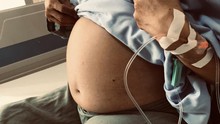 Tưởng béo bụng nên chủ quan không đi khám, cụ bà 'tá hỏa' phát hiện khối u gần 10kg trong người 