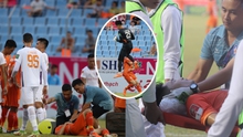 Va chạm kinh hoàng ở V-League: Cầu thủ Đà Nẵng vào viện sau khi lĩnh trọn đầu gối của thủ môn đối phương