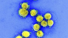 WHO theo dõi biến thể mới của virus SARS-CoV-2 đang lan rộng ở Anh và Mỹ