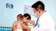 Thành phố Hồ Chí Minh: Yêu cầu các cơ sở y tế sẵn sàng ứng phó bệnh sởi gia tăng